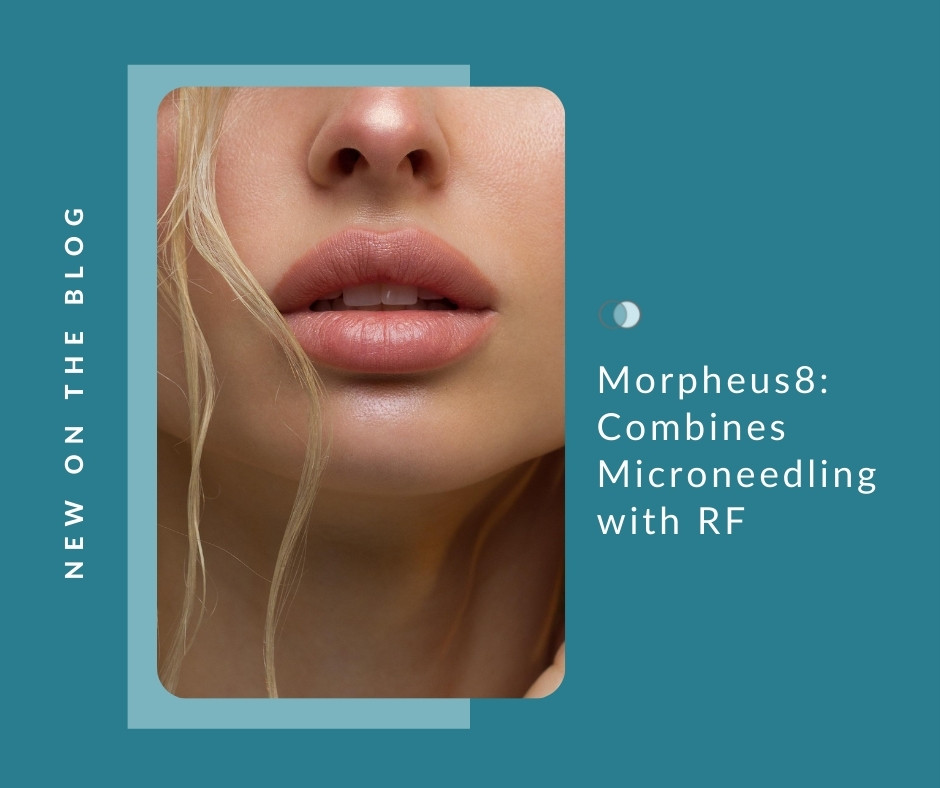 Morpheus8: Technology Combines Microneedling with RF | Palo Alto Laser