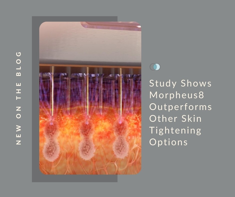 Study Shows Morpheus8 Outperforms Skin Tightening | Palo Alto Laser