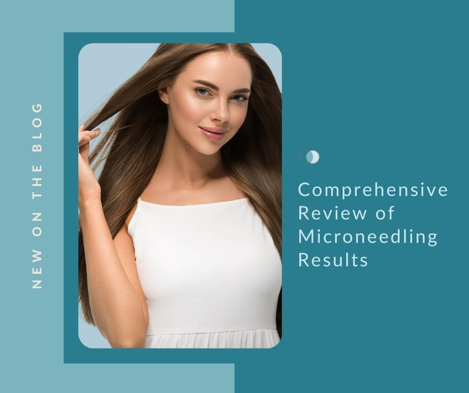 Comprehensive Review of Microneedling Results | Palo Alto Laser