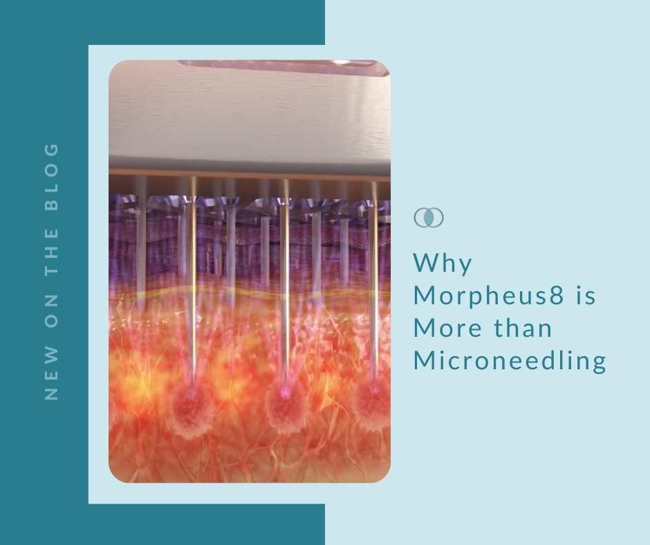 Why Morpheus8 is More than Microneedling | Palo Alto Laser