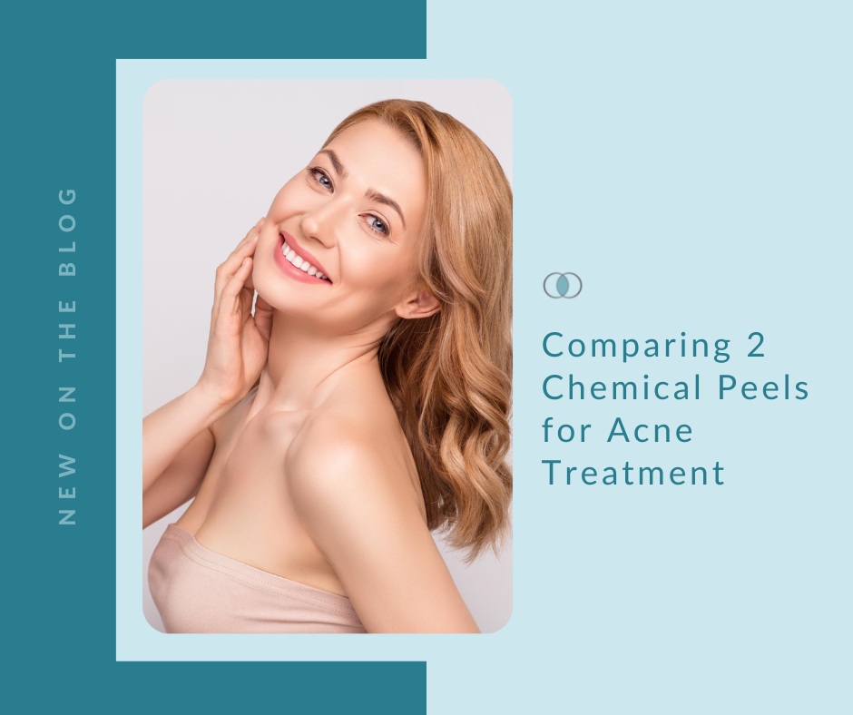 Comparing 2 Chemical Peels for Acne | Palo Alto Laser