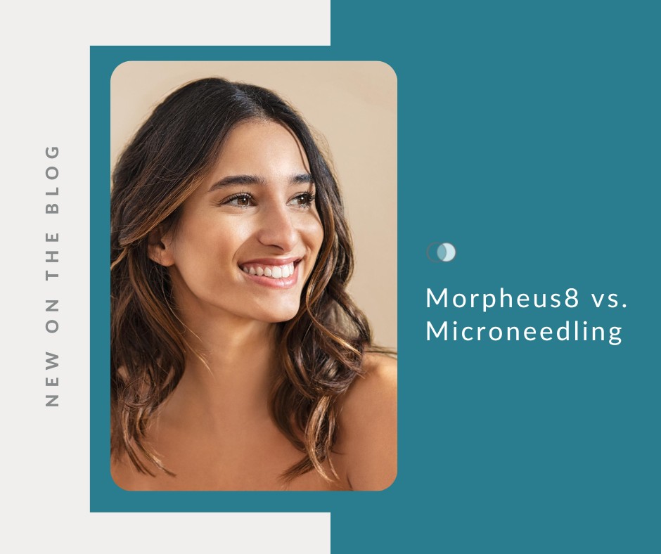 Morpheus8 vs. Microneedling | Palo Alto Laser & Skin Care