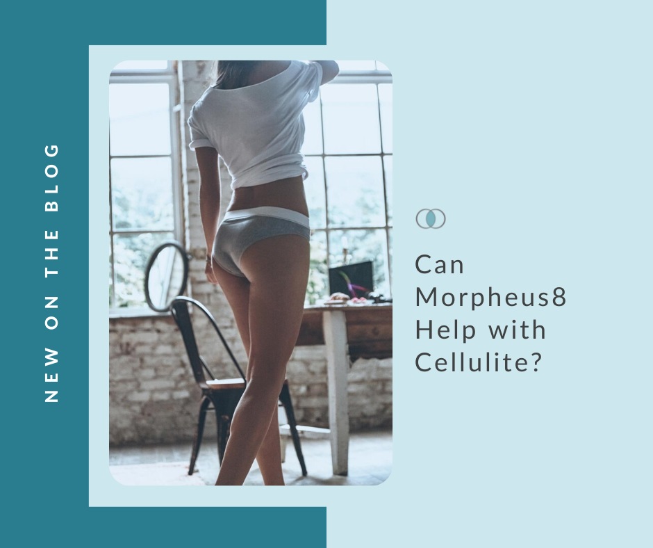 Can Morpheus8 Help with Cellulite? | Palo Alto Laser & Skin Care