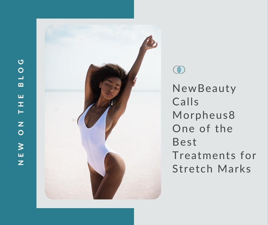 Morpheus8 the Best Treatments for Stretch Marks | Palo Alto Laser