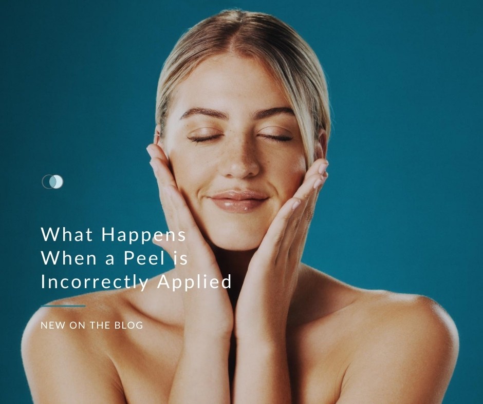 What Happens When a Peel is Incorrectly Applied | Palo Alto Laser
