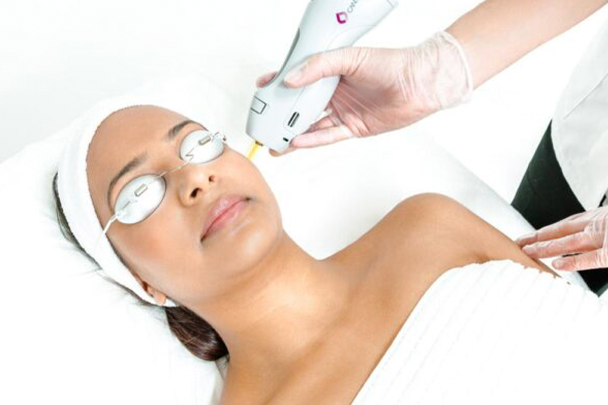 Woman happy to get rid of hair on her face with laser hair removal in Palo Alto.